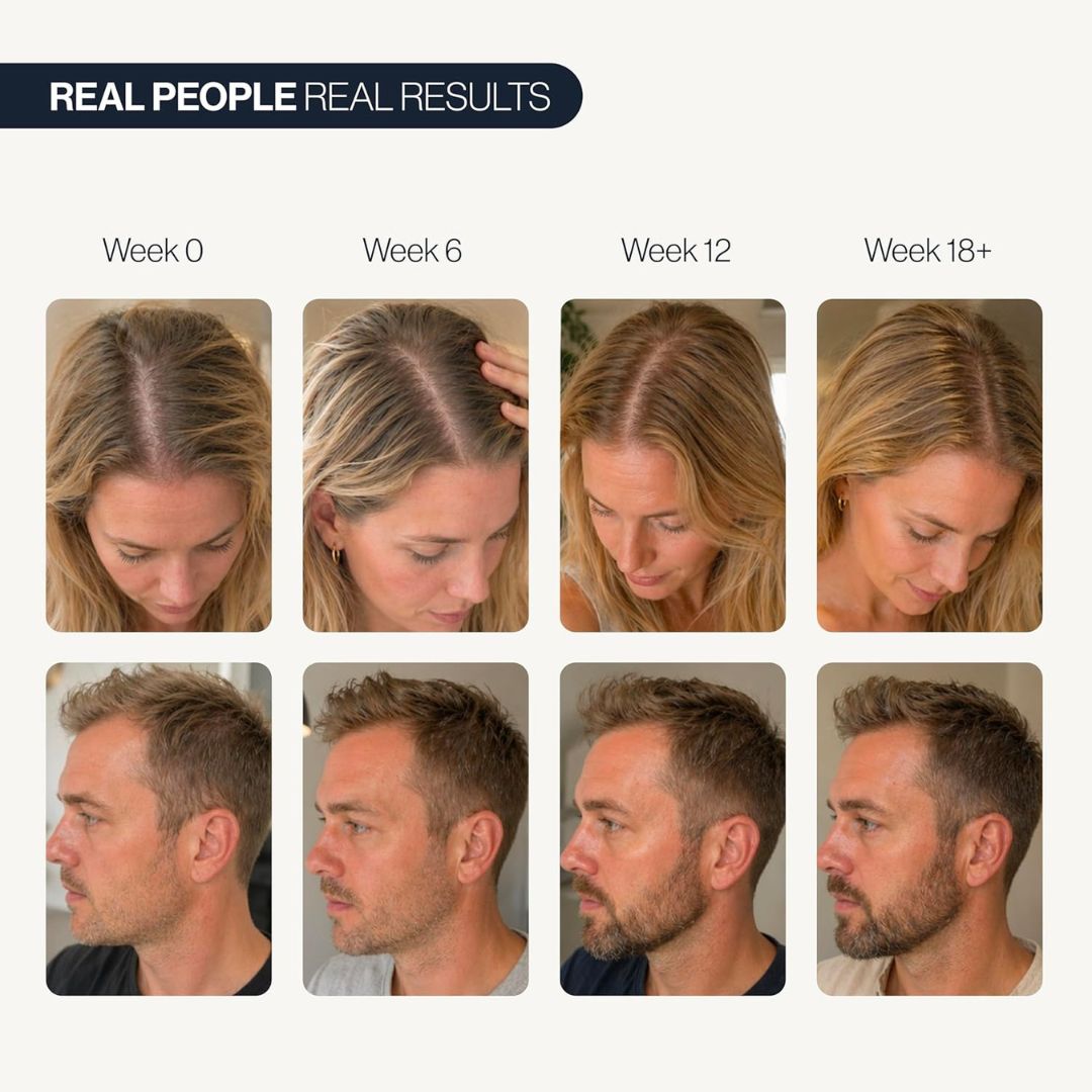 RoseRoot™ Hair Roll-On