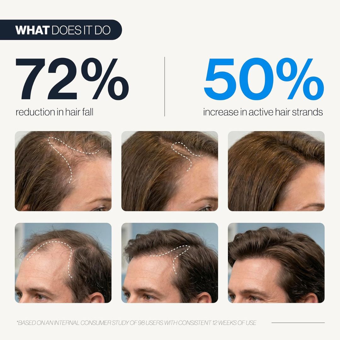 RoseRoot™ Hair Roll-On