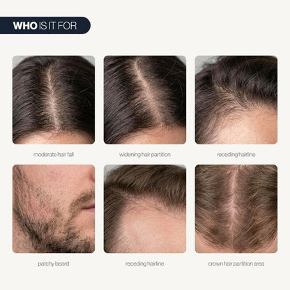 RoseRoot™ Hair Roll-On